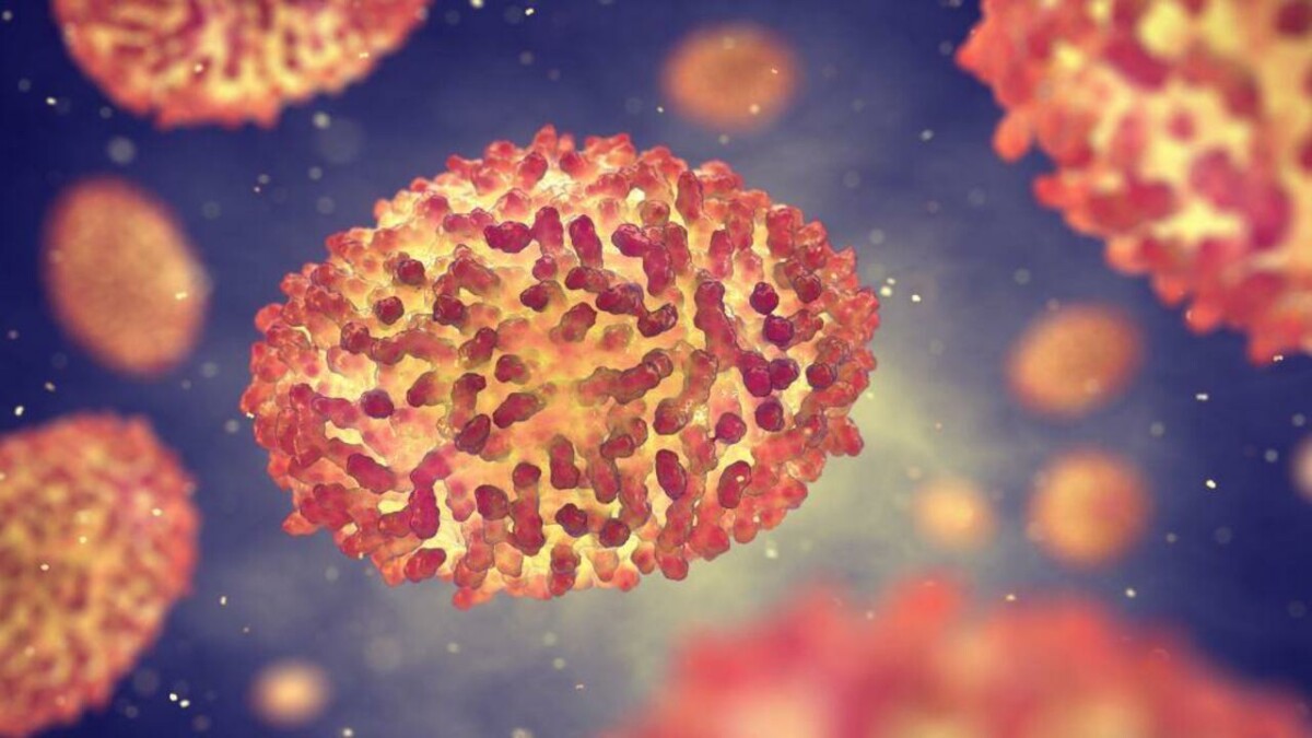 Varíola dos macacos: Brasil chega à marca de 5 mil casos; Amazonas tem 27 casos confirmados