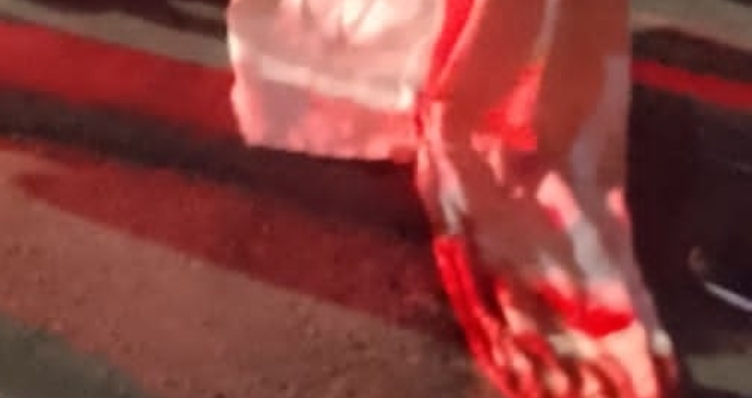 Homem é brutalmente executado a tiros no bairro Colônia Santo Antônio; veja