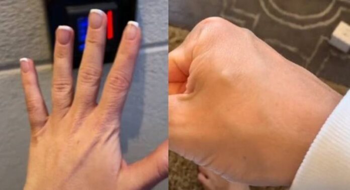 Casal implanta chips no corpo e controla casa onde mora com tecnologia