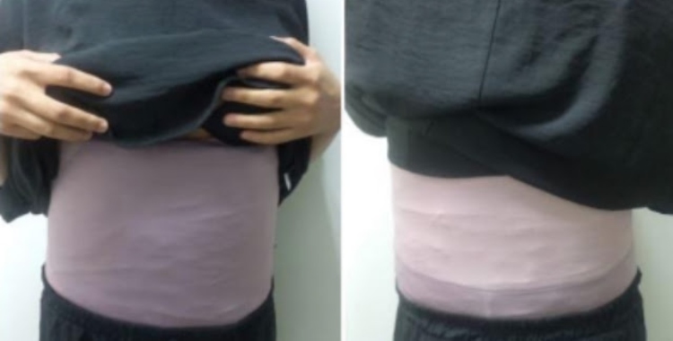 Mulher é presa no aeroporto de Manaus com drogas enroladas no corpo