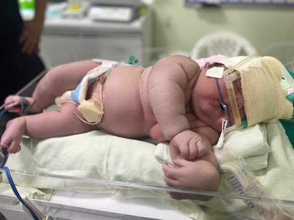 ‘Bebê Gigante’ nasce com mais de 7 kg em maternidade de Parintins