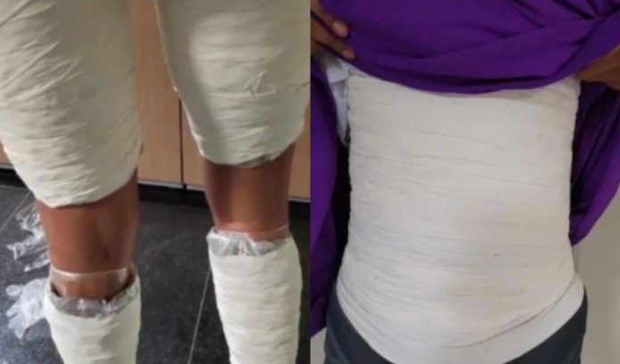 Grávida é presa após tentar embarcar com drogas amarradas ao corpo em Manaus