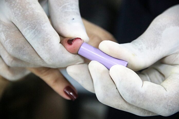 Prefeitura alerta população sobre cuidados com a Covid-19 após aumento de casos em Manaus