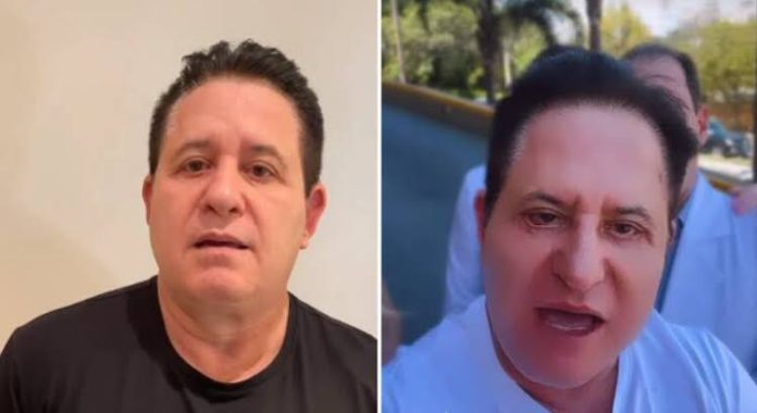 Marrone choca internautas ao mostrar resultado de sua cirurgia facial