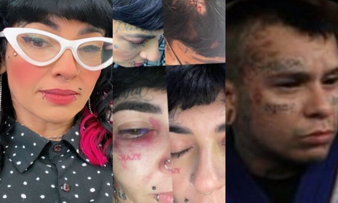 Esposa de lutador de Manaus expõe violência doméstica nas redes sociais; imagens