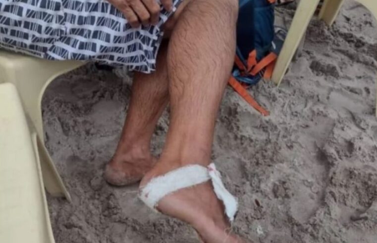 Ataque de Piranhas: Banhistas ficam feridos após cardume de peixes atacá-los em balneário de Manaus