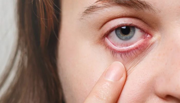 Covid: Primeiro caso da variante arcturus é confirmado no Brasil