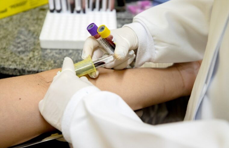 Inicia em Manaus oferta de novo teste para diagnosticar tuberculose latente