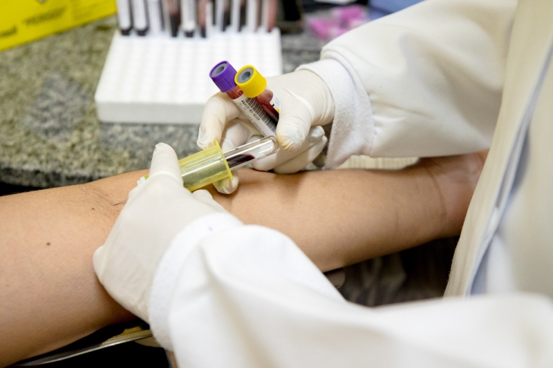 Inicia em Manaus oferta de novo teste para diagnosticar tuberculose latente