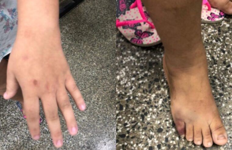 Em Manaus, homem é preso por agredir a própria enteada após término de relacionamento