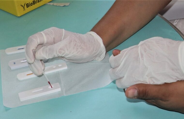 Prevenção combinada contra IST’s é medida para manter a saúde sexual durante Festival de Parintins