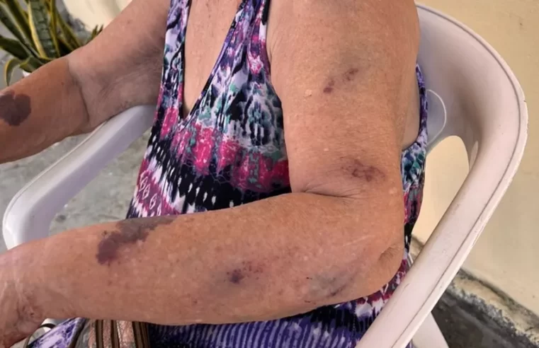 Idosa de 87 anos é agredida pela neta com cabo de vassoura em Manaus