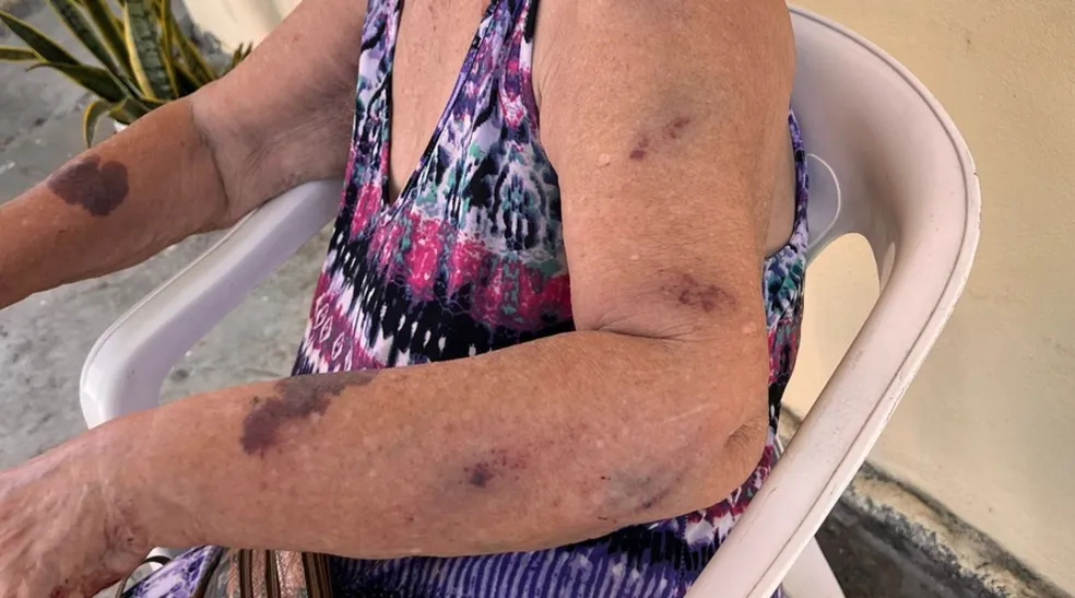 Idosa de 87 anos é agredida pela neta com cabo de vassoura em Manaus