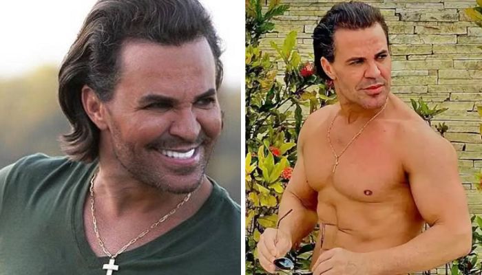 Cantor Eduardo Costa nega ter realizado harmonização facial: ‘Nunca fiz’