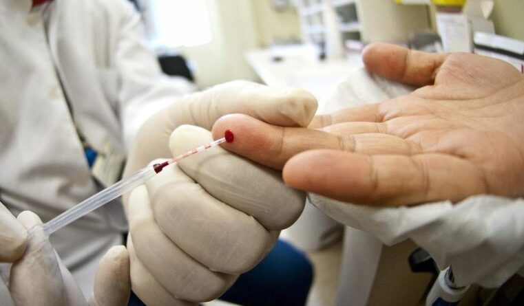 Amazonas registra redução de casos de HIV/Aids, mas ainda apresenta aumento em relação a 2020￼