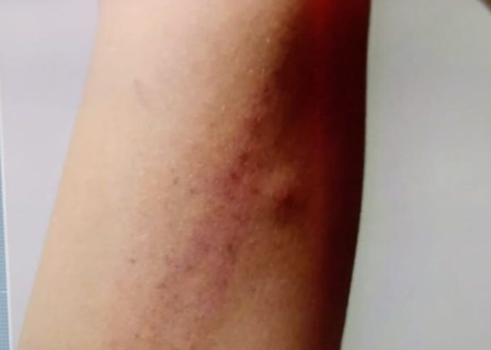 Aluno do Colégio da Polícia Militar é agredido após briga por futebol em Manaus