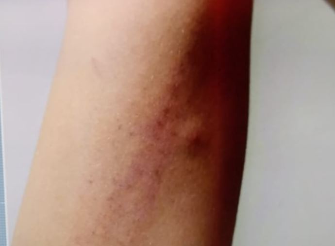 Aluno do Colégio da Polícia Militar é agredido após briga por futebol em Manaus