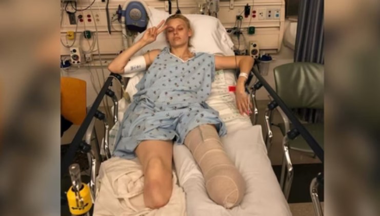 Jovem tem as duas pernas amputadas e quase perde a vida após uso de absorvente interno