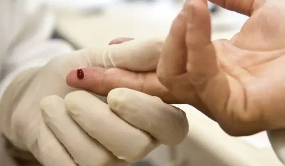 Cientistas anunciam sétimo paciente provavelmente curado do HIV no mundo