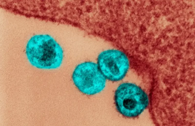 Nova variante do HIV está circulando em três estados do Brasil, diz estudo