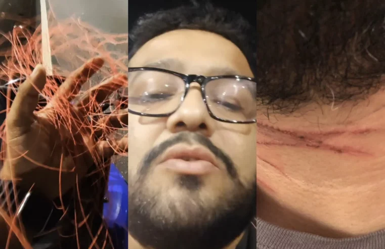 Jornalista quase morre degolado por linha de cerol em Manaus: “grande livramento”