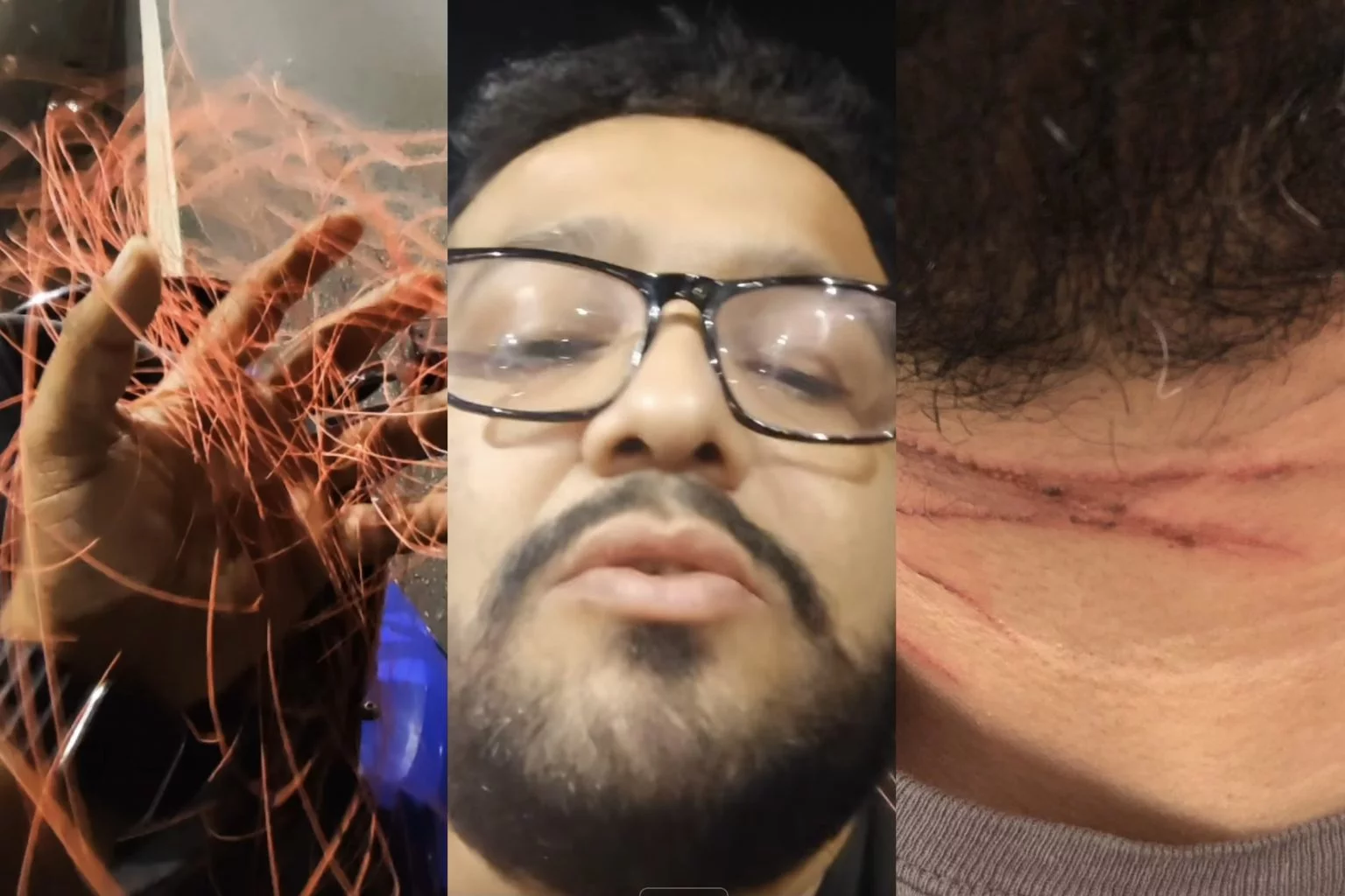 Jornalista quase morre degolado por linha de cerol em Manaus: “grande livramento”