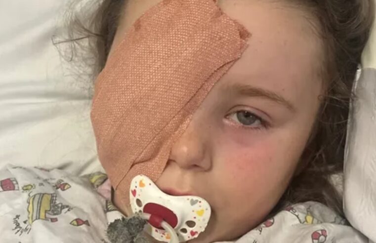 Garotinha de 7 anos perde olho após explosão de bateria de vape