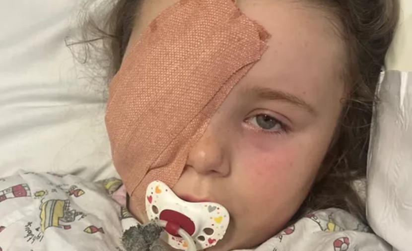 Garotinha de 7 anos perde olho após explosão de bateria de vape