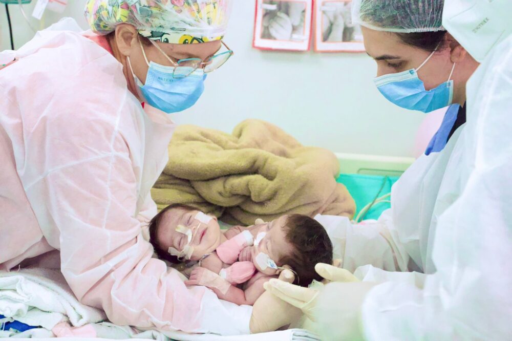 Gêmeas siamesas nascidas na Maternidade Ana Braga são separadas com sucesso em cirurgia em Goiânia