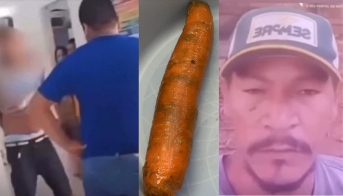 VÍDEO: Homem que procurou UPA com cenoura presa no ânus esclarece polêmica