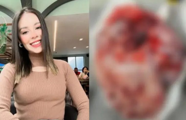 Jovem de Manaus luta contra câncer agressivo e precisa de ajuda urgente